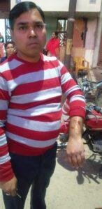 कानपुर13फरवरी2023*पालतू पागल कुत्ते के हमला करने से लोगों का बना जान का खतरा* कानपुर13फरवरी2023*पालतू पागल कुत्ते के हमला करने से लोगों का बना जान का खतरा*