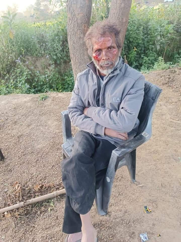 कानपुर देहात15फरवरी*बुलडोजर अगर चलता है तो कहीं भी किसी भी अवैध कब्जेदार को न छोड़े सरकार, तब तो न्याय है-सुरेश वर्मा। कानपुर देहात15फरवरी*बुलडोजर अगर चलता है तो कहीं भी किसी भी अवैध कब्जेदार को न छोड़े सरकार, तब तो न्याय है-सुरेश वर्मा।
