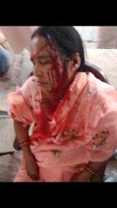 लखनऊ19फरवरी*दो पक्ष में मारपीट हुई महिला को मार मार कर लहूलुहान कर दिया गया । लखनऊ19फरवरी*दो पक्ष में मारपीट हुई महिला को मार मार कर लहूलुहान कर दिया गया ।
