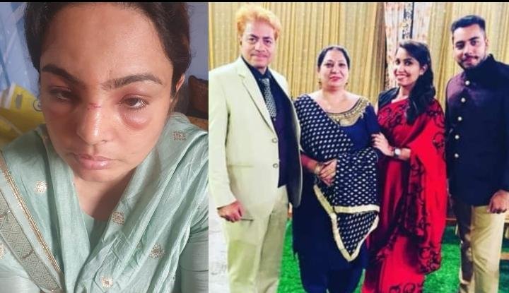 अबोहर 31 मार्च* ससुराल पक्ष द्वारा बहु से मारपीट पति, सास-ससुर व ननद के खिलाफ मामला दर्ज।