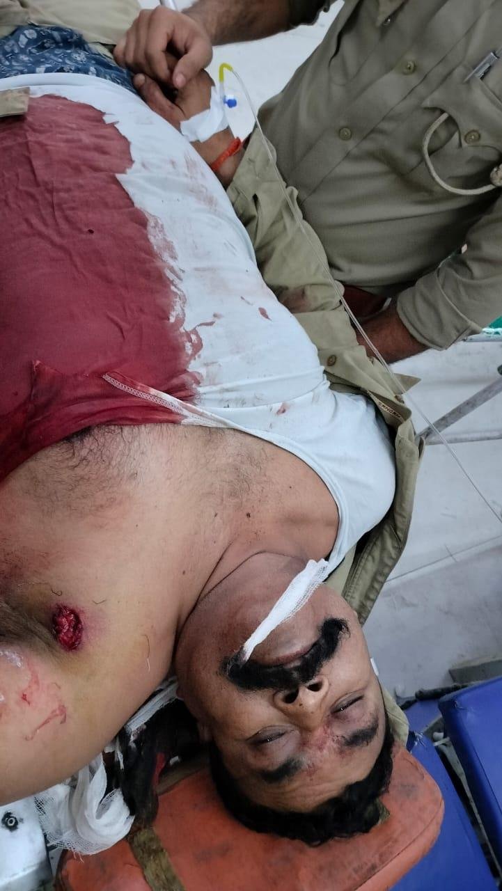 लखीमपुर खीरी25अप्रैल*मैगलगंज थाना क्षेत्र के लिधियाई गांव के पास गस्त कर रहे सिपाही को बदमाश ने मारी गोली।