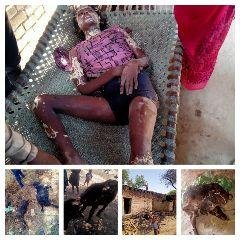 कौशाम्बी10मई23*दलित के घर में लगी आग बेटी गंभीर झुलसी* कौशाम्बी10मई23*दलित के घर में लगी आग बेटी गंभीर झुलसी*