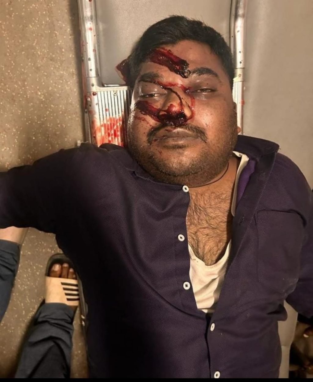 लखनऊ12जून2023*राजधानी में प्रापर्टी डीलर की गोली मारकर हत्या!