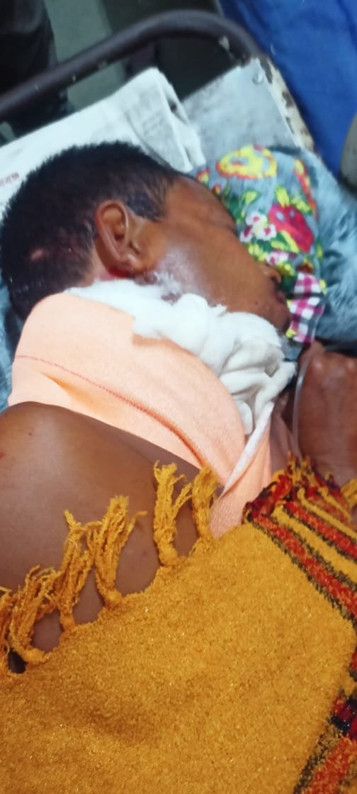 पश्चिम बंगाल20जून2023*पंचायत चुनाव से पहले एक और गर्म दिन, एक घायल।