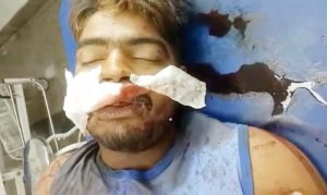 पंजाब27जून2023*सौतेले बेटे पर पिता ने किया हमला, पुलिस ने किया मामला दर्ज