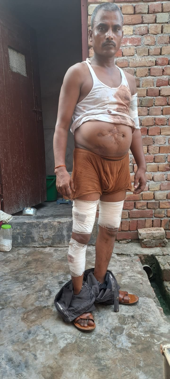 मथुरा05जुलाई23* पत्नी ने अपने भाई और मां के साथ मिलकर पति पर किया धारदार हथियार से प्रहार।