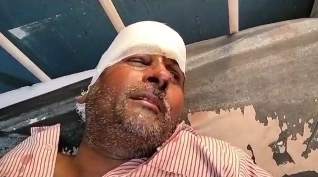 बांदा29जुलाई23*तेज रफ्तार ट्रकों की आमने-सामने की टक्कर में ट्रक ड्राइवर की मौत क्लीनर गंभीर रूप से घायल*