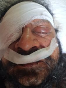 कानपुर नगर25सितम्बर23*भाजपा के पार्षद ने साइड न मिल पाने के कारण दवा व्यापारी की नाक आंख फोड़ी* 👁️