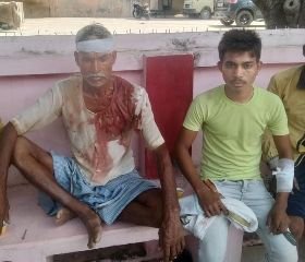 कौशाम्बी27सितम्बर23*ससुरालियों ने दामाद को पीटा,बीच बचाव करने गए 2 पड़ोसी जख्मी*