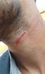 लखनऊ29सितम्बर23*पतंग के मांझे से युवक का गला कटा*