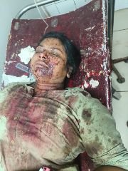 कानपुर12अक्टूबर23*वाहन में हवा भरने वाला सिलेंडर फटा।