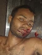 कानपुर17अक्टूबर23*नशे की हालत में घूम रहे अज्ञात युवक की एक्सीडेंट में मृत्यु।