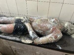 गोण्डा20अक्टूबर23*युवक के आत्मदाह का मामला 90 प्रतिशत झुलसे युवक दिव्यराज की मौत,