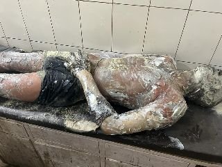 गोण्डा20अक्टूबर23*युवक के आत्मदाह का मामला 90 प्रतिशत झुलसे युवक दिव्यराज की मौत,