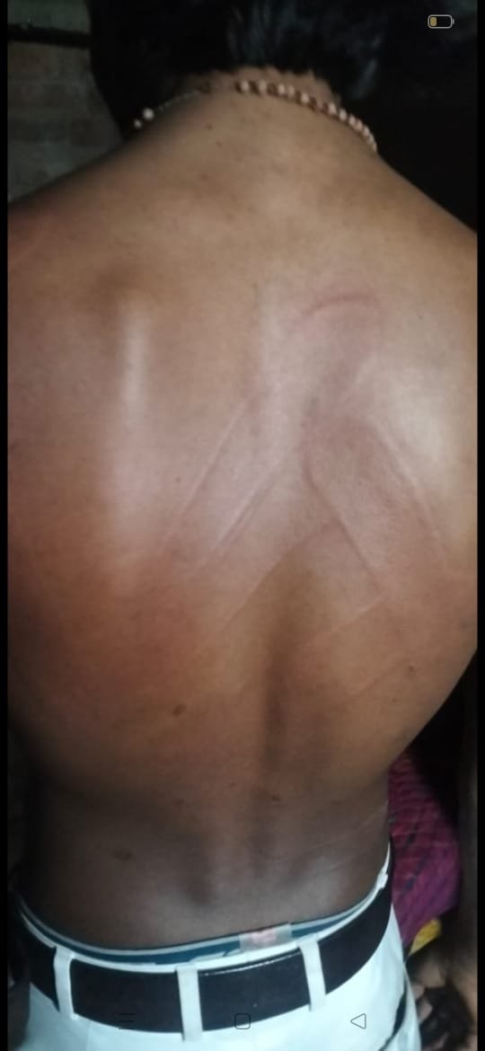 कौशाम्बी18नवम्बर23*नशे में धुत दबंगों ने रास्ते में रोककर युवक को जमकर पीटा*