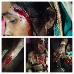 कौशाम्बी24जनवरी24*महिला और उसके परिवार वालों पर दबंगो ने किया जानलेवा हमला* कौशाम्बी24जनवरी24*महिला और उसके परिवार वालों पर दबंगो ने किया जानलेवा हमला*