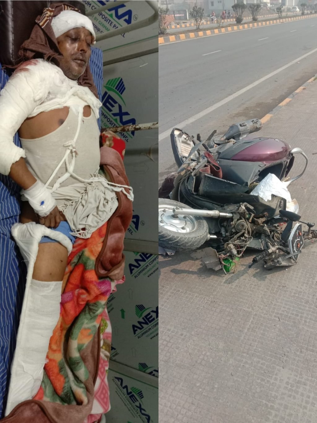 कुशीनगर16फरवरी24*ट्रक की ठोकर से स्कूटी चालक घायल,रेफर कुशीनगर16फरवरी24*ट्रक की ठोकर से स्कूटी चालक घायल,रेफर