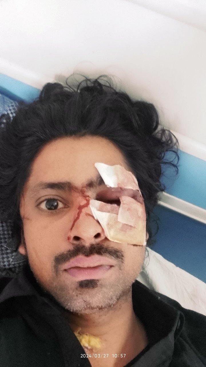 औरैया27मार्च24*दबंगों ने युवकों को पीटा हालत गंभीर पीजीआई रेफर औरैया27मार्च24*दबंगों ने युवकों को पीटा हालत गंभीर पीजीआई रेफर