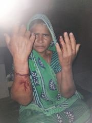 कौशाम्बी08अप्रैल24*बहु ने पिता के साथ मिलकर सास को डंडों से पीटकर किया चोटिल*