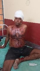 औरैया28जून24*पति को पानी मांगना पड़ा महंगा,पत्नी ने कुल्हाड़ी से फोड़ा सिर*