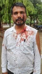 कौशांबी29जून24* पश्चिम शरीरा थाना पुलिस ने घायल विजय पांडे पर ही दर्ज कर दिया मुकदमा*