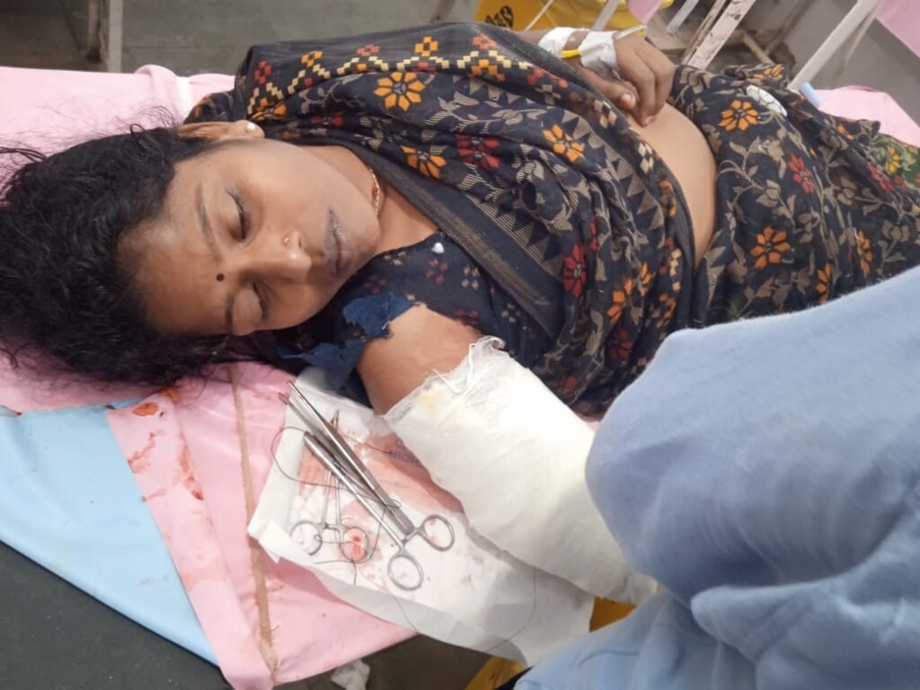 अनुपपुर 30 जुलाई 24*कलेक्टर ऑफिस ड्यूटी में आ रही महिला स्कूटी एवं ट्रैक्टर एक्सीडेंट में घायल,भर्ती जिला चिकित्सालय में*