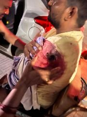 कौशांबी21जुलाई24*ससुराल जा रहे युवक के ऊपर अज्ञात बदमाशों ने तमंचे से झोंका फायर*