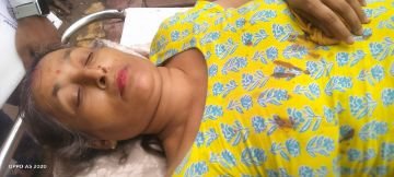 मथुरा7अगस्त24*ऑटो और रिक्से केे ऐक्सिडेंट में श्रद्धालु महिला गम्.भीर रूप से घायल।