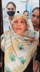 प्रयागराज10अगस्त24*आटो चालक की लापरवाही से आधा दर्जन सवारी घायल*