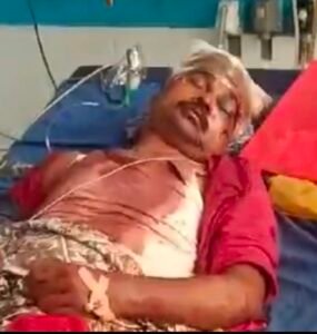 *भागलपुर बिहार*०१०/०९/२४*वार्ड 51 के पार्षद पति पर जानलेवा हमला ! एसएसपी ने मामले को आपराधिक नहीं, आपसी विवाद बताया*