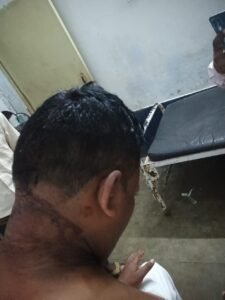 कुशीनगर18अक्टूबर24*पत्रकार पर,डॉक्टर की डिग्री पूँछने पर झोलाछाप डॉक्टर ने किया जानलेवा हमला।