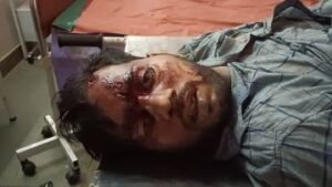 फर्रुखाबाद3अक्टूबर24*हादसे में शिक्षक की मौत*