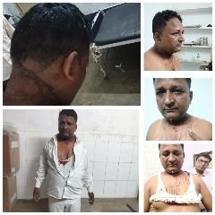कुशीनगर18अक्टूबर24*पत्रकार पर,डॉक्टर की डिग्री पूँछने पर झोलाछाप डॉक्टर ने किया जानलेवा हमला।