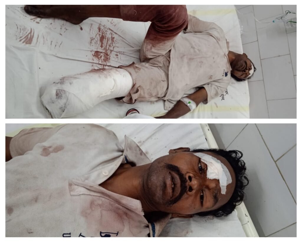 अनूपपुर 08 अक्टूबर 24*ट्रेन से गिरने पर युवक का कटा पैर, विशेषज्ञ डॉक्टरो ने किया ऑपरेशन