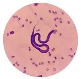 पटना27नवम्बर24*राज्य में फाइलेरिया प्रसार दर मापने को 24 जिलों में हो रहा है नाइट ब्लड सर्वे