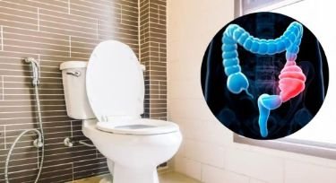 वाराणसी03जनवरी25*गलत तरीके से बैठने के कारण इंग्लिश टॉयलेट से होता कब्ज-डॉ0 मीनाक्षी