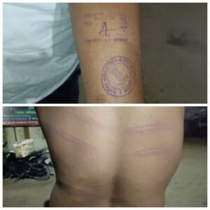 भागलपुर27जनवरी25*जेल के अंदर पैसे की मांग को लेकर रिहा हो रहा है कैदी को जेल सिपाही ने जमकर पीटा*