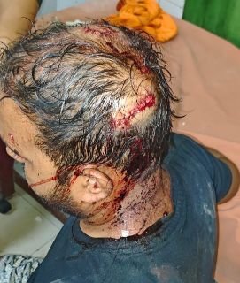 लखनऊ02मार्च25*आलमबाग में खूनी संघर्ष, पुलिस की लापरवाही से दबंग बेखौफ!,