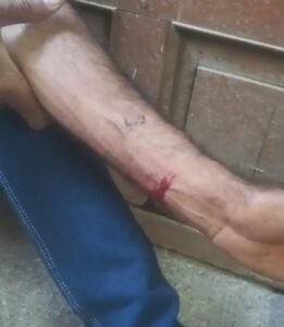 भोपाल10मार्च*पत्नी ने किया पति पर जानलेवा हमला।