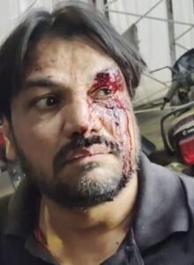 लखनऊ23मार्च25*थाना बाजारखला के अंतर्गत खैरातखाना लखनऊ में नदीम हुसैन पर जानलेवा हमला ।