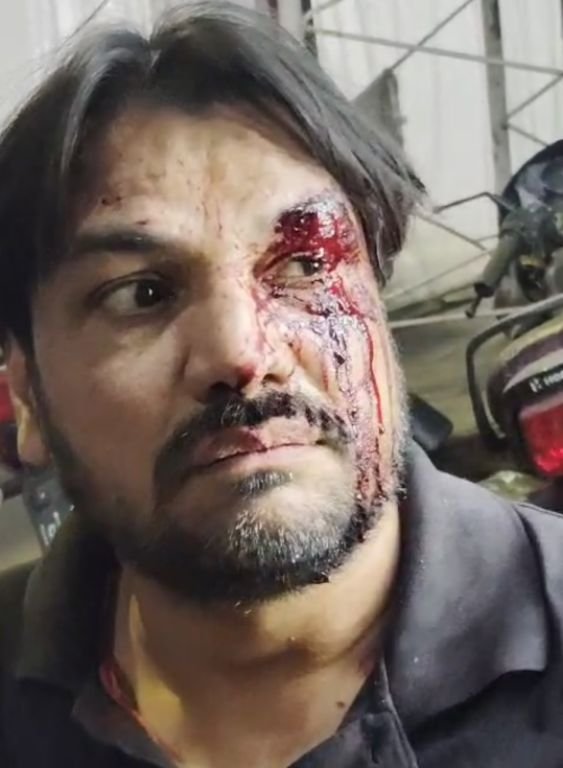 लखनऊ23मार्च25*थाना बाजारखला के अंतर्गत खैरातखाना लखनऊ में नदीम हुसैन पर जानलेवा हमला । लखनऊ23मार्च25*थाना बाजारखला के अंतर्गत खैरातखाना लखनऊ में नदीम हुसैन पर जानलेवा हमला ।