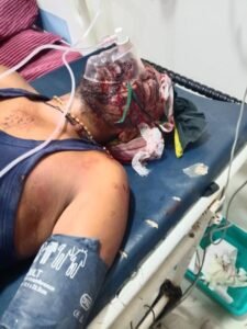 रीवा 23अप्रैल25 मे मिसिरगवां देवतालाब विधान सभा क्षेत्र निवासी अशुतोष मिश्रा पर हुआ जानलेवा हमला!*