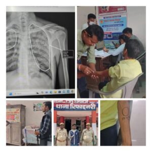 पूर्णिया बिहार 16 अप्रैल25* संभावित टीबी ग्रसित मरीजों की पहचान के लिए जिला यक्ष्मा केंद्र में जांच कैम्प