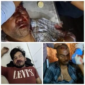 कानपुर नगर26अप्रैल25*बाइकों की आमने-सामने टक्कर में तीन घायल एक की हालत नाजुक सभी जिला अस्पताल रेफर