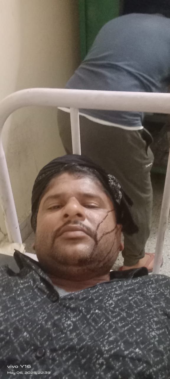 अयोध्या07मई25 पुत्र राहुल सिंह द्वारा किया गया प्राण घातक हमला