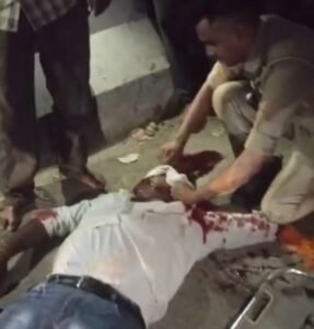 अयोध्या04मई2025*दो बाइको की टक्कर में एक की मौत दूसरा फरार