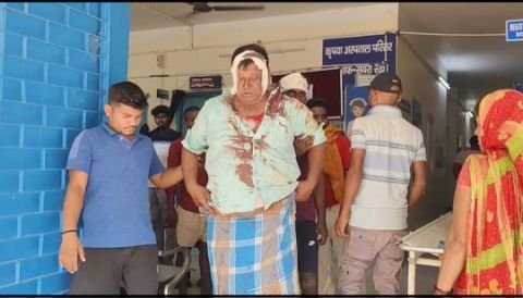 भागलपुर13मई25*नाथनगर में जमीन विवाद को लेकर हिंसक झड़प, एक दर्जन से अधिक जख्मी*