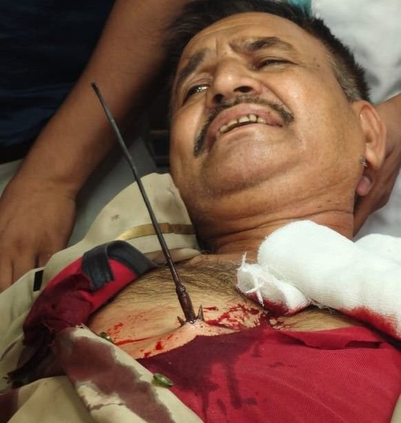 लखनऊ23मई25* CBI कार्यालय में हमला: ASI वीरेंद्र सिंह पर धनुष-बाण से वार, आरोपी हिरासत में*