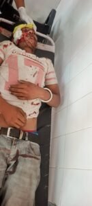 सहारनपुर19जून25*सड़क दुर्घटना में गंभीर रूप से घायल अभी तक पहचान नहीं हो पा रही है