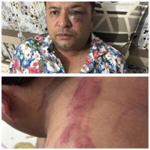 लखनऊ6जून25*राजधानी के चिनहट में अधिवक्ता अभिषेक गुप्ता पर देर रात कातिलाना हमला। लखनऊ6जून25*राजधानी के चिनहट में अधिवक्ता अभिषेक गुप्ता पर देर रात कातिलाना हमला।